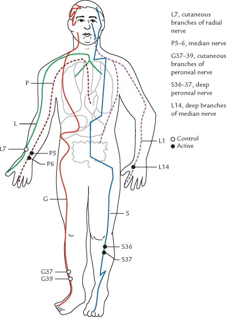 Diagram of meridians and acupuncture points